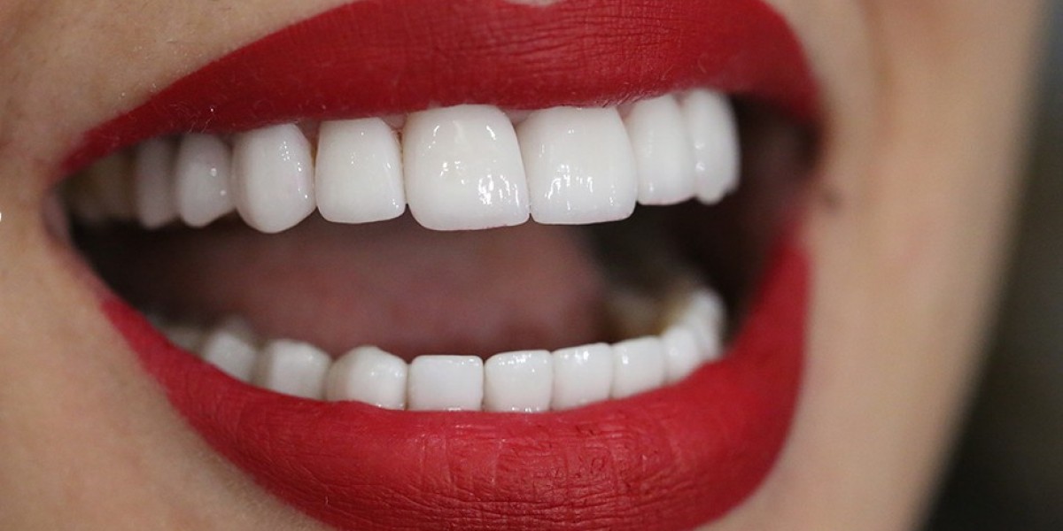 Breaking Down the Costs: How Much Does a Hollywood Smile Makeover Cost?