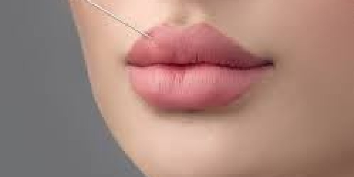 Lip Enhancement in Russia: Exploring the Most Popular Fillers