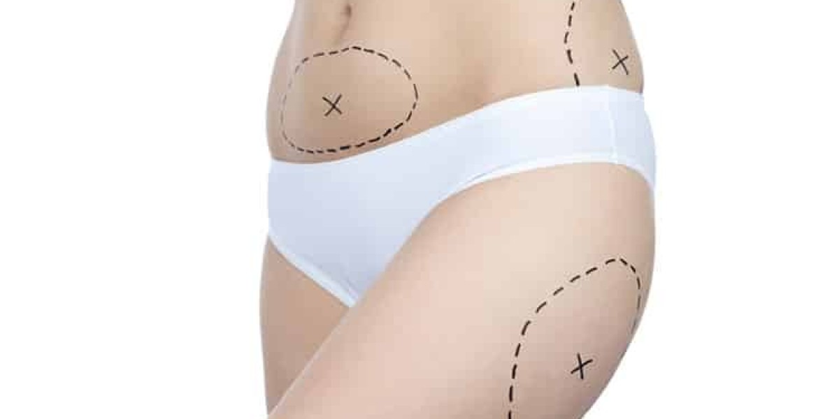 Liposuction Myths Debunked: Separating Fact from Fiction