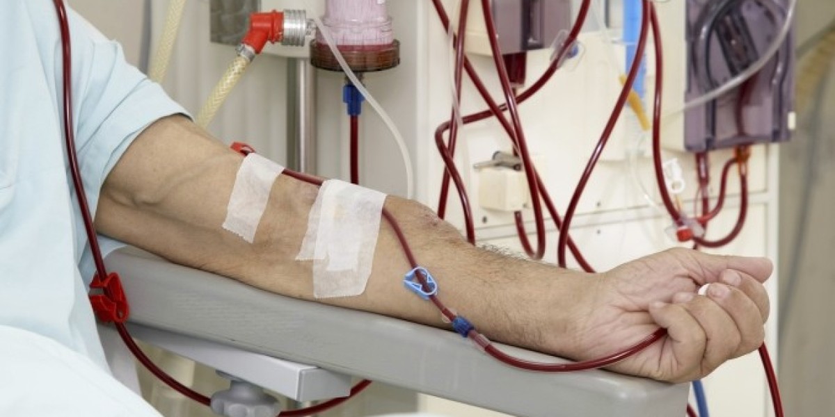 Hemodialysis Market 2023 | Industry Trends, Share and Forecast 2028