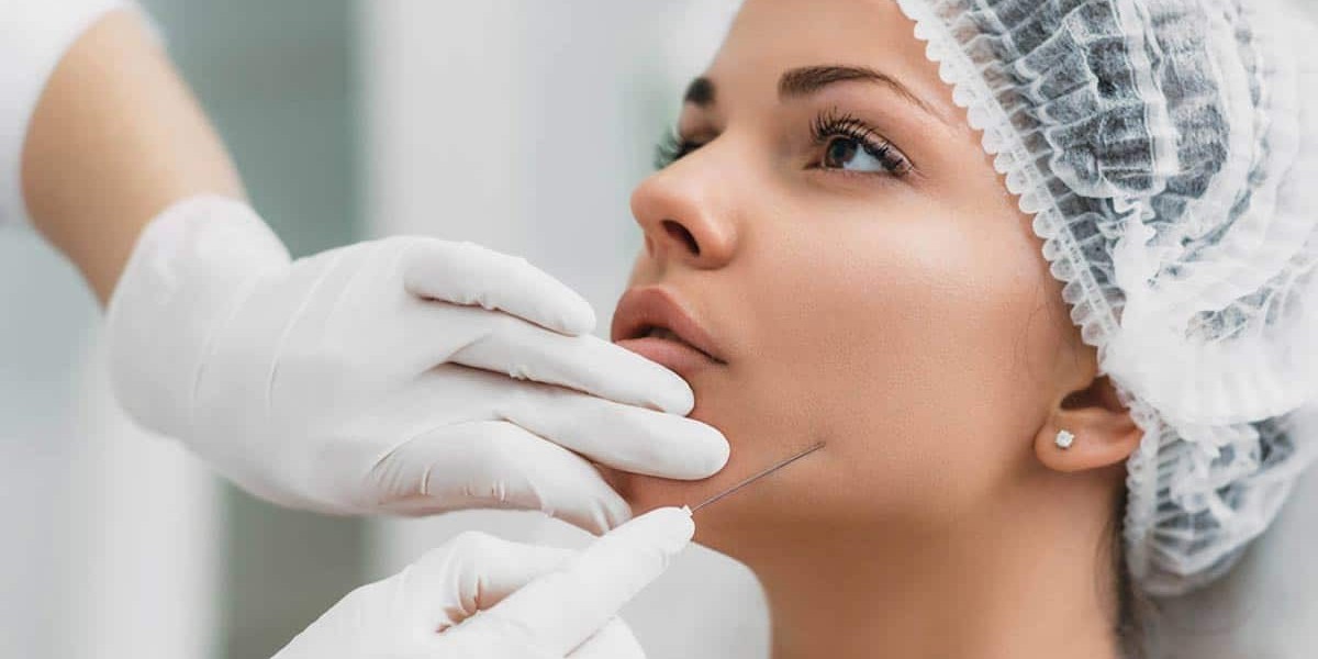Elevate Your Confidence with Thread Lift: A Look into the Procedure