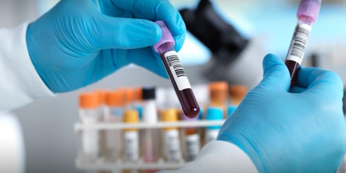 Research and Analysis of the Blood Screening Market: Size and Share Insights