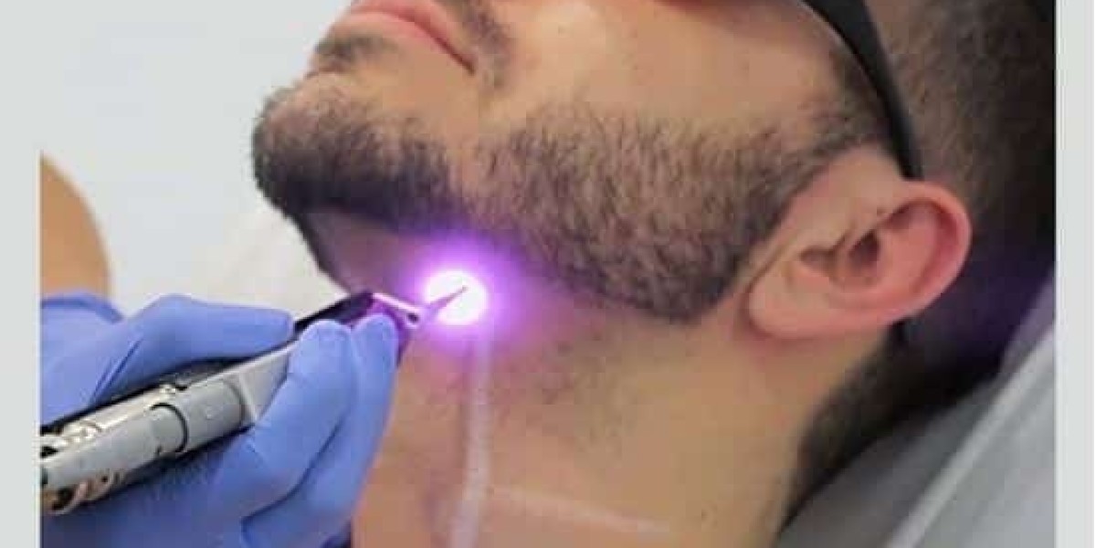 Erase Beard Strays: Laser Hair Removal for Sharp Lines
