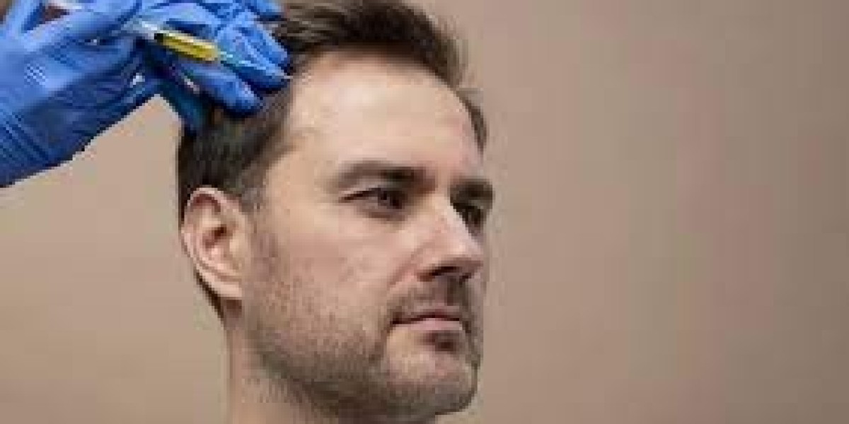 Hair Transplant Islamabad: Transforming Your Look and Confidence