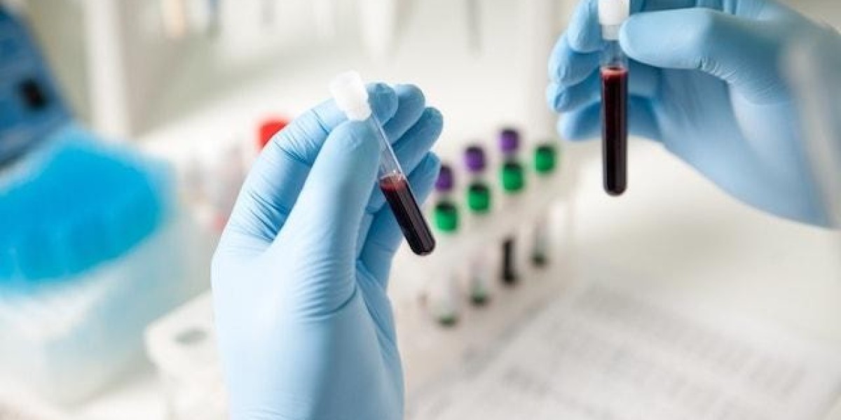 Sexually Transmitted Disease (STD) Diagnostics Market 2023 | Industry Size and Forecast 2028