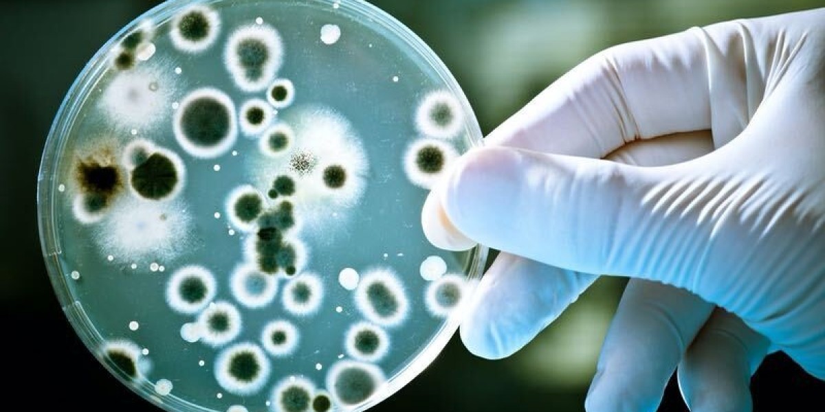 Legionella Testing Market Size, Share, Growth and research 2022 Forecast to 2032.