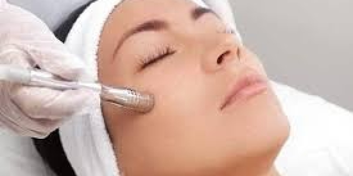 Microneedling for Neck and Décolletage: Rejuvenate Your Profile