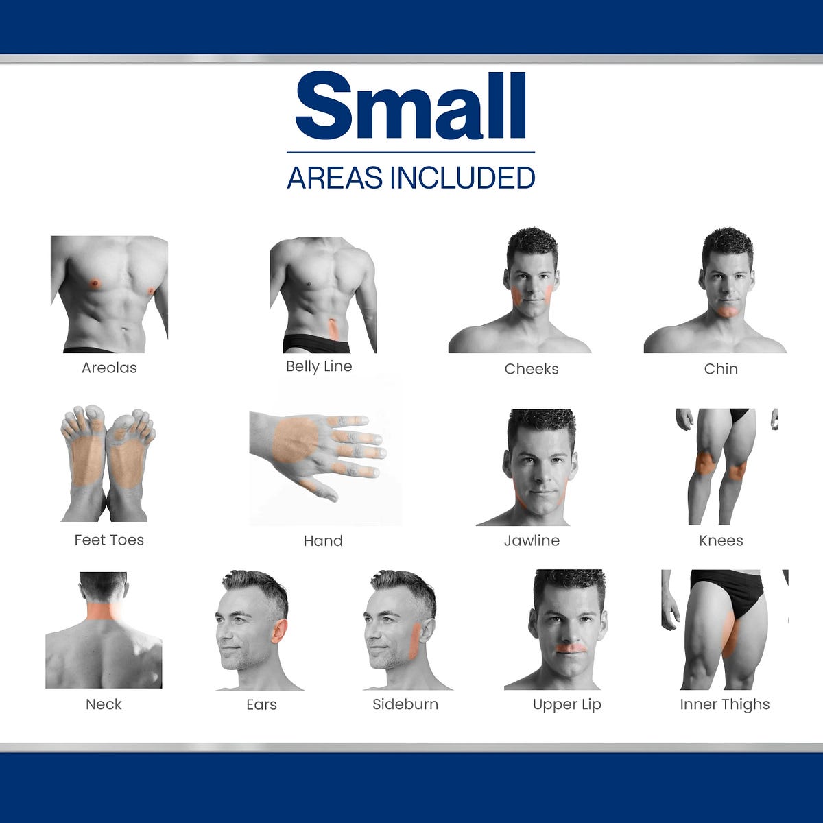 Laser Hair Removal for Men in Norwalk: The Complete Guide