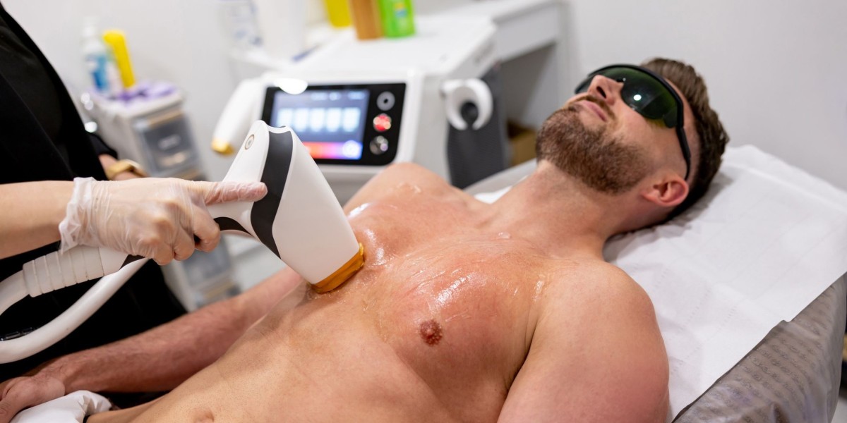 Laser Hair Removal for Men: Grooming and Beyond
