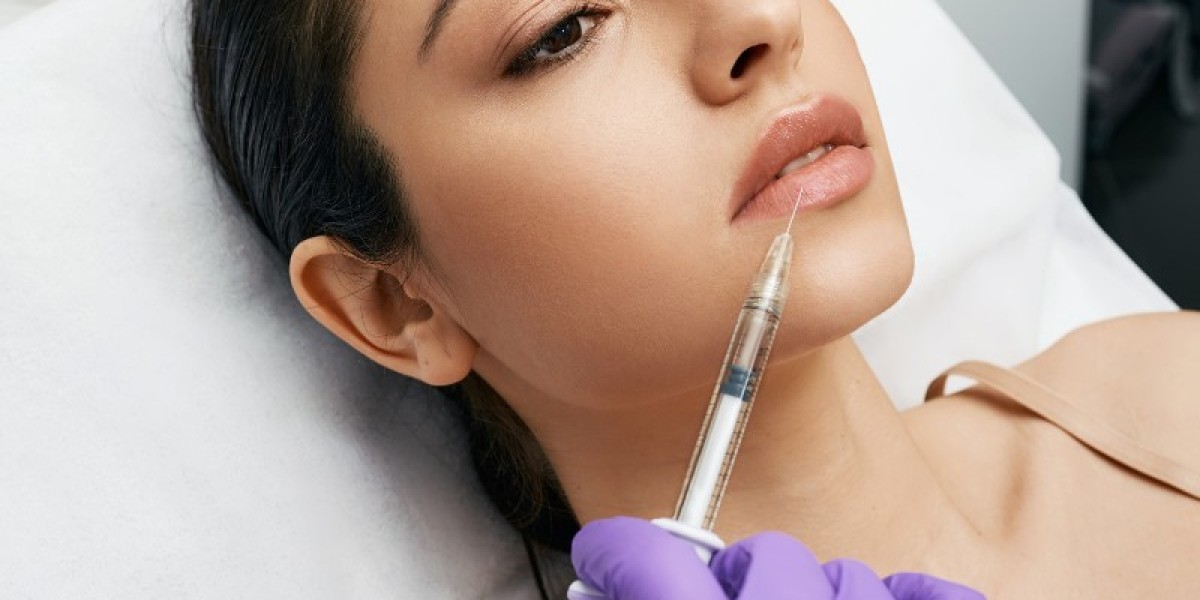 Lip Filler for Age-Defying Beauty: A Youthful Smile