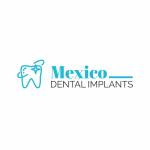 Mexico Dental Implants