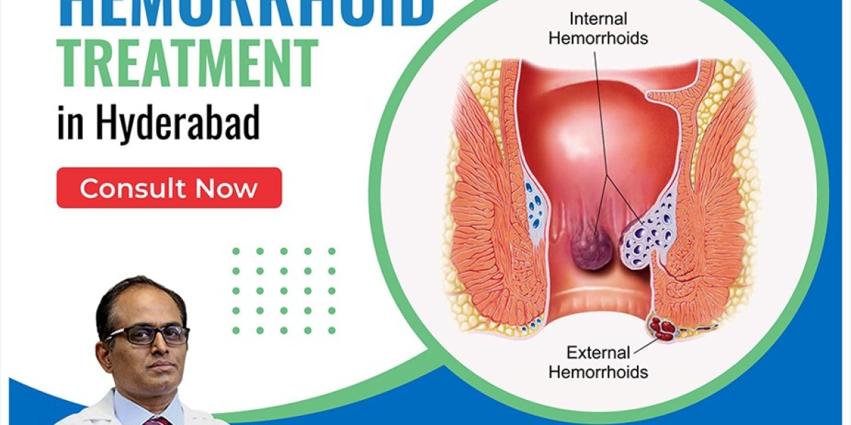 Haemorrhoids Treatment in Hyderabad