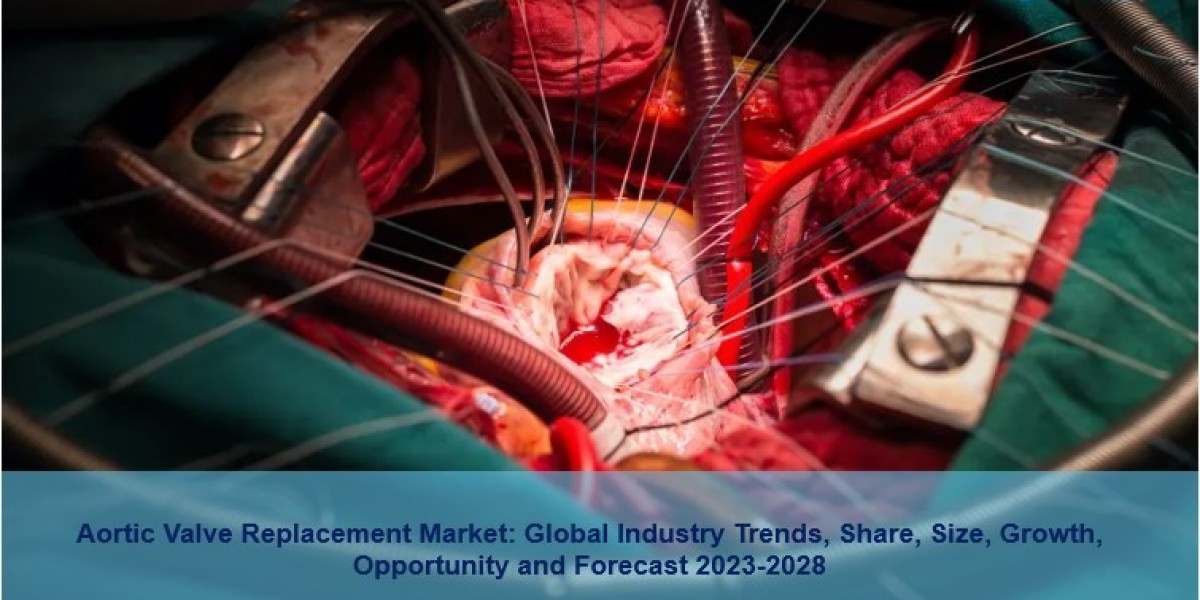 Aortic Valve Replacement Market 2023 | Size, Growth, Trends And Forecast 2028
