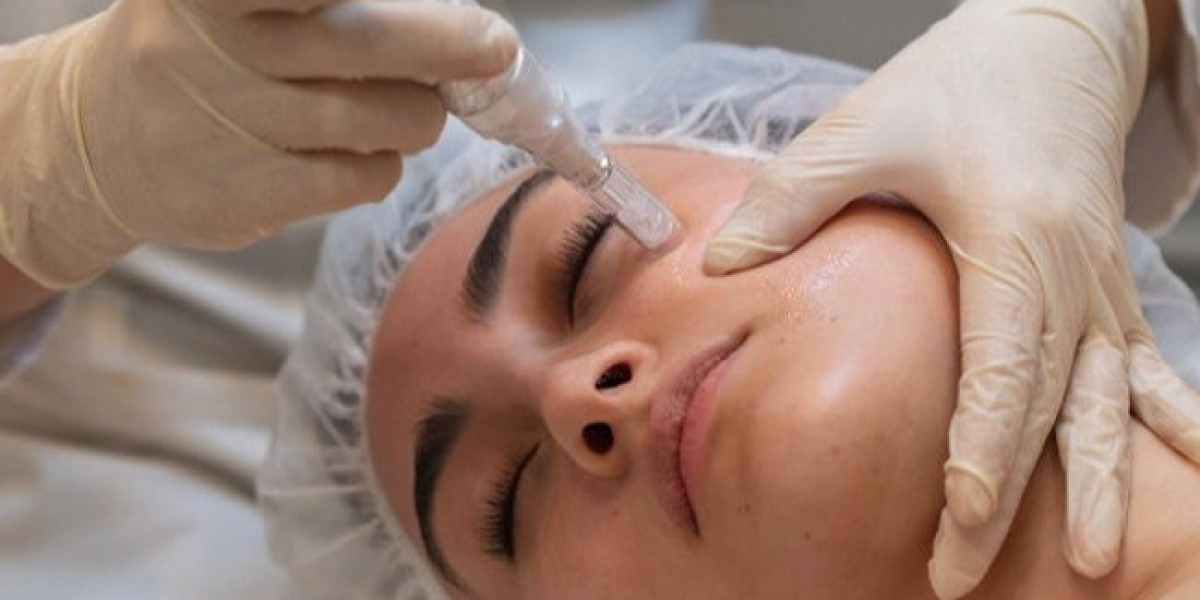 Microneedling and Sun Damage: Reversing the Effects