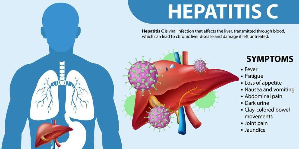Detect and Treat Hepatitis C Early: The Importance of Testing for Timely Intervention
