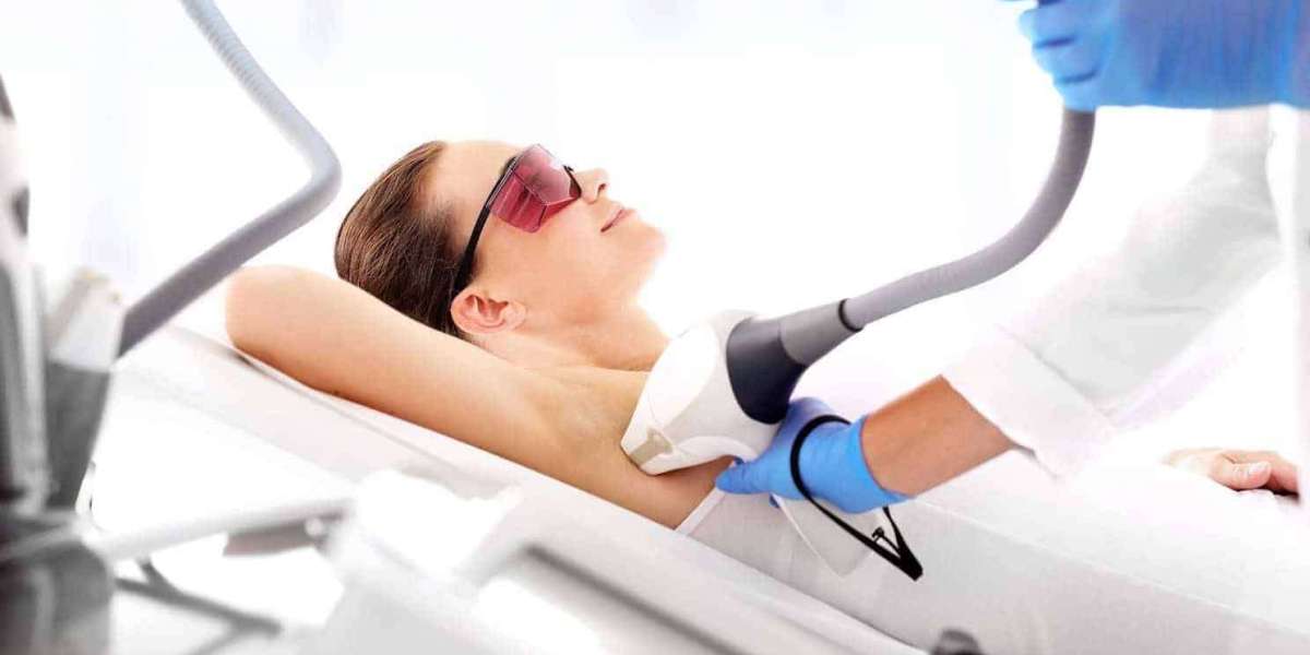 Laser Hair Removal: Your Ultimate Treatment Handbook