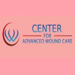 CenterFor WoundCare