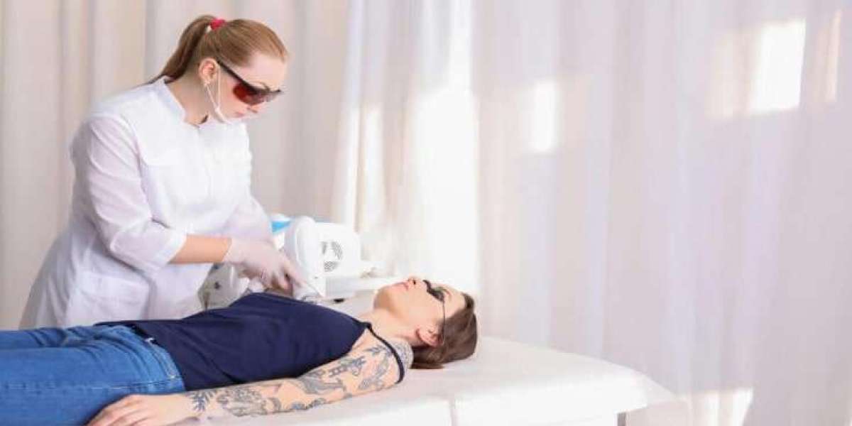Reclaim Your Canvas: How Laser Tattoo Removal Redefines Your Look