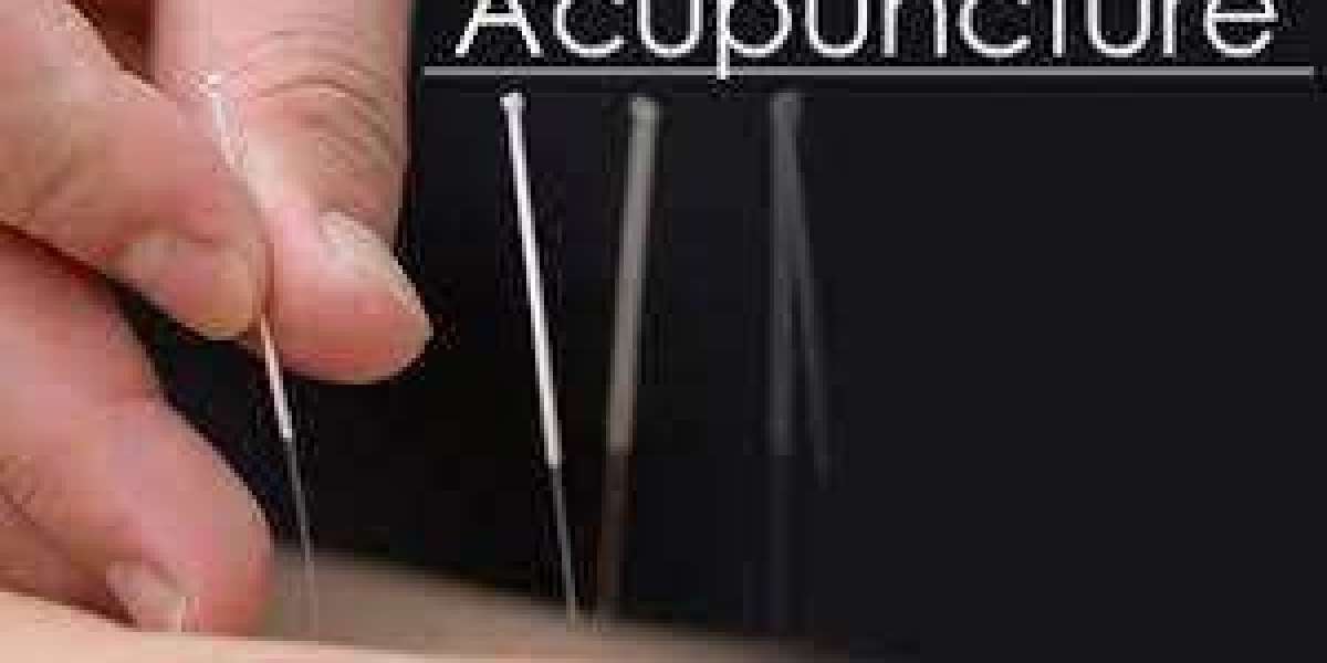 Feel Better with Acupuncture in Morristown Your Wellness Solution