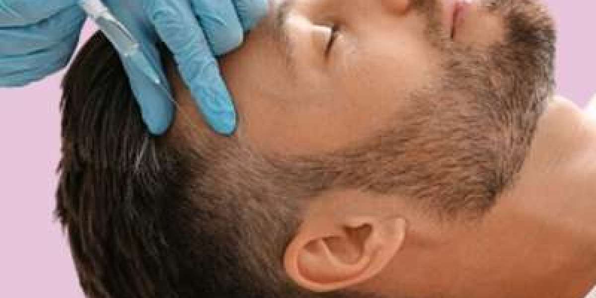 PRP Hair Treatment: The Natural Alternative to Medications