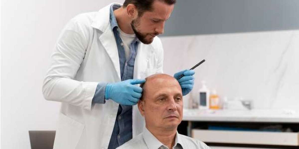Unlocking the Secrets of Hair Loss: Insights from Alopecia Specialists