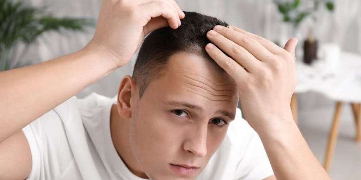 Strand by Strand: How the Number of Grafts Affects Hair Transplant Cost