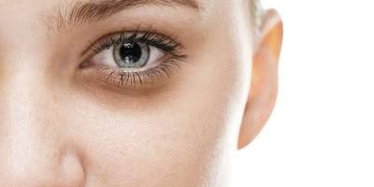 The Dubai Glow-Up: Stem Cell Treatments for Under-Eye Circles!
