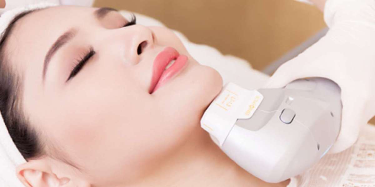 The Future of Facial Rejuvenation: Ultherapy Unleashed