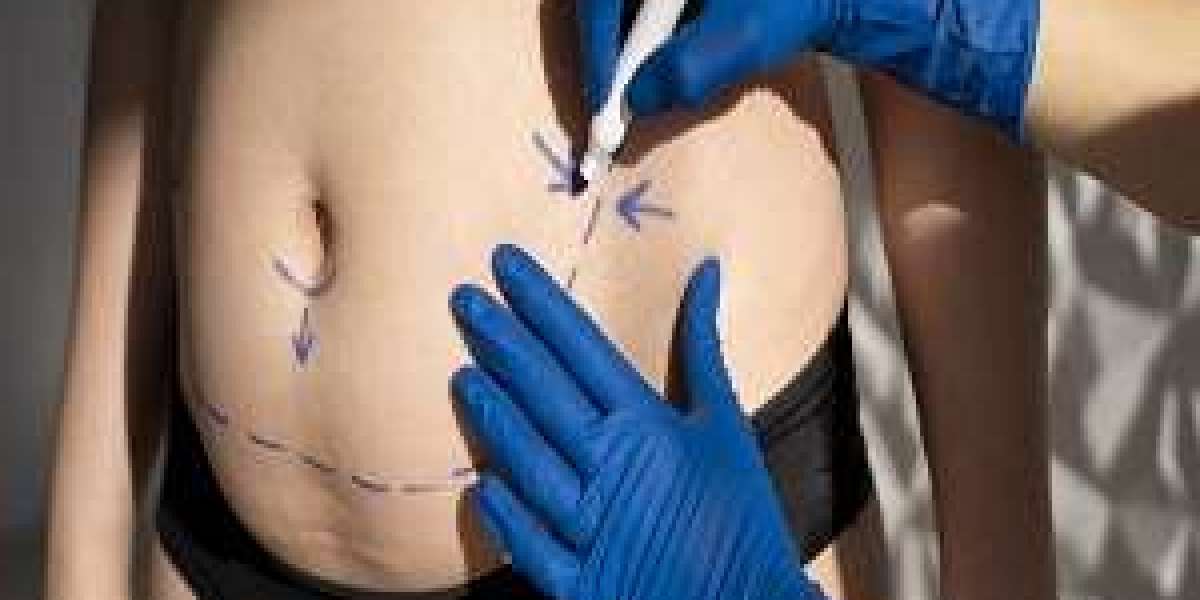 Effortless Beauty: The Appeal of Fat Dissolving Injections in Dubai
