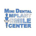 Mini Dental Implant Smile Center