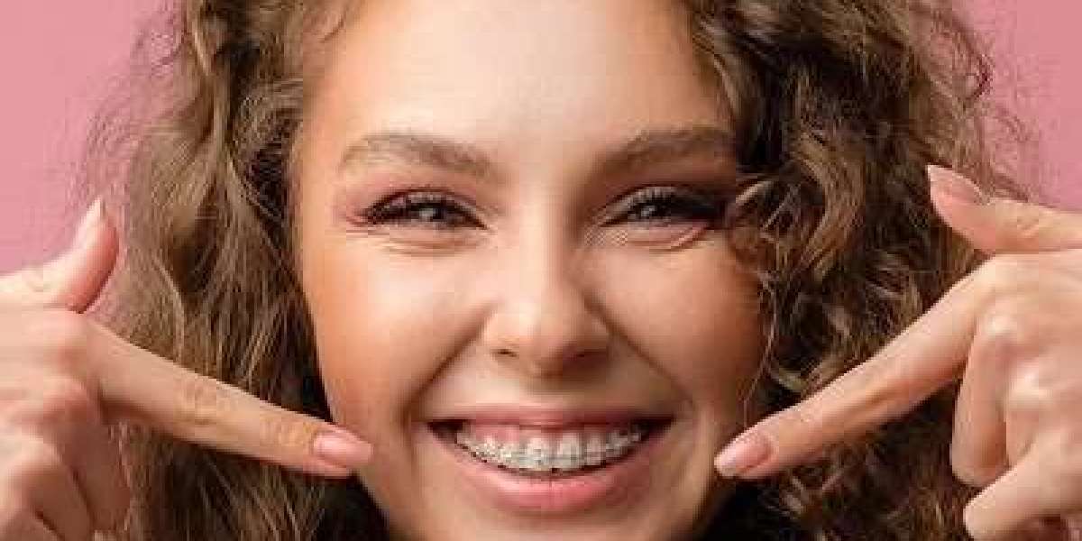 A Complete Guide to Understanding Dental Braces: Types, Benefits, and Costs
