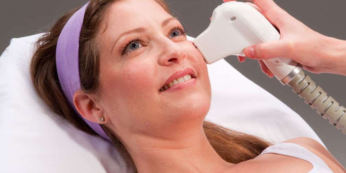 Firm and Fabulous: Laser Skin Tightening