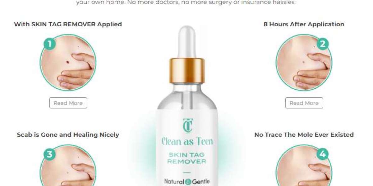 Clean As Teen Skin Tag Remover Official