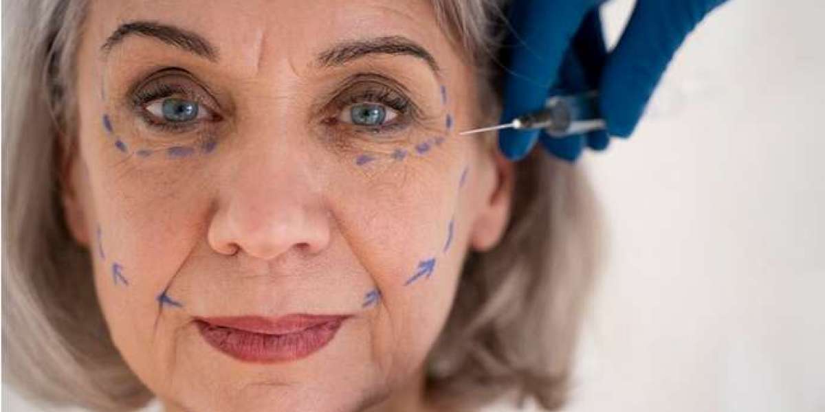 London's Secret to Youthful Skin: A Guide to Anti-Wrinkle Injections