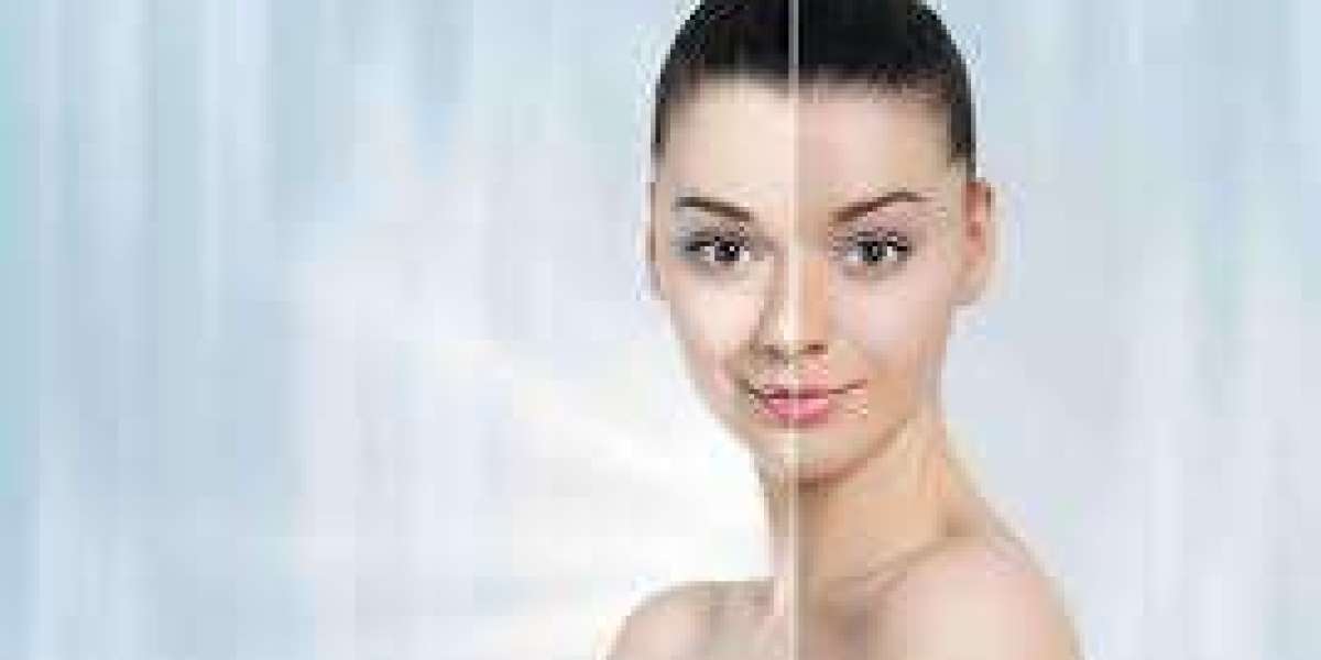Uncover the beauty of even skin tone with our specialized Skin Whitening Treatment in Dubai.
