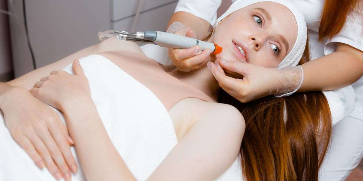 Customizing Your Beauty Routine: Targeted Skincare with Hydrafacial