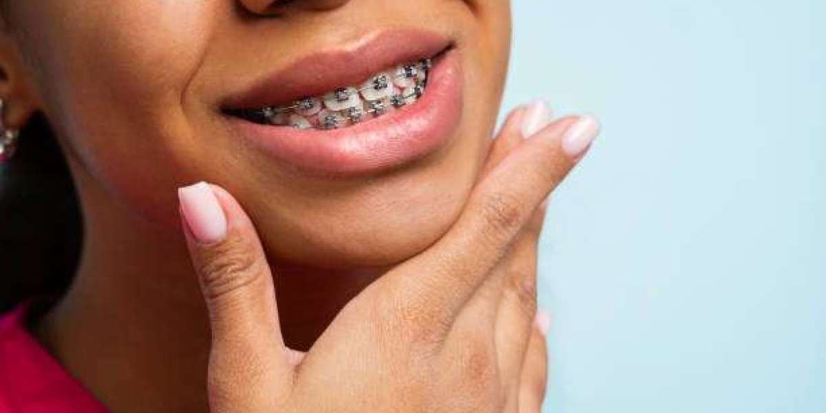 Maintaining Oral Health: Preventing Issues During and After Metal Braces Treatment in Abu Dhabi