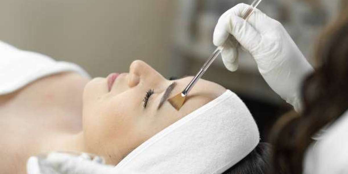 The Power Within: How Chemical Peels Revitalize Your Skin