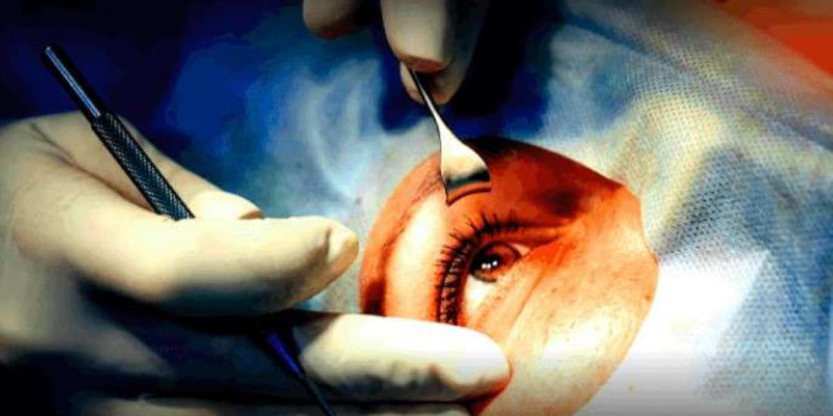 Cataract Surgical Devices Market Comprehensive Analysis, Forecast to 2026