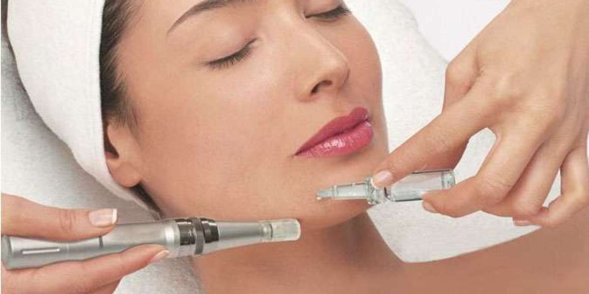 "Needle Perfection: Enhancing Skin Texture with Dermapen"