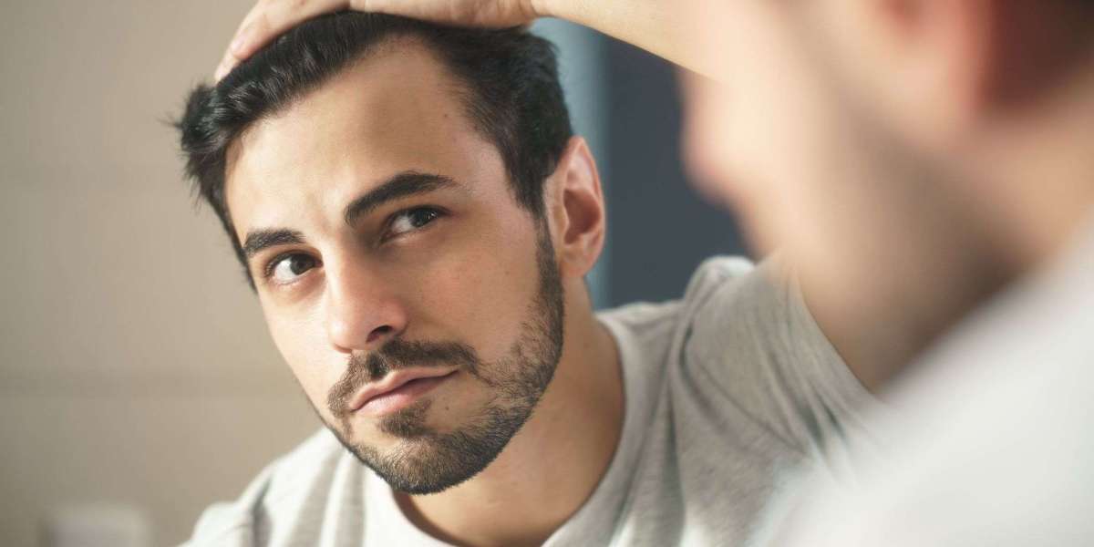 Male Pattern Baldness: Treating the Most Common Form of Hair Loss