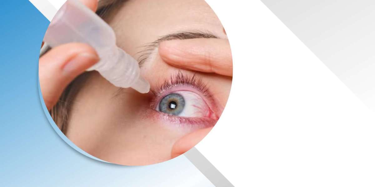 Best PCD Pharma Eye Drops