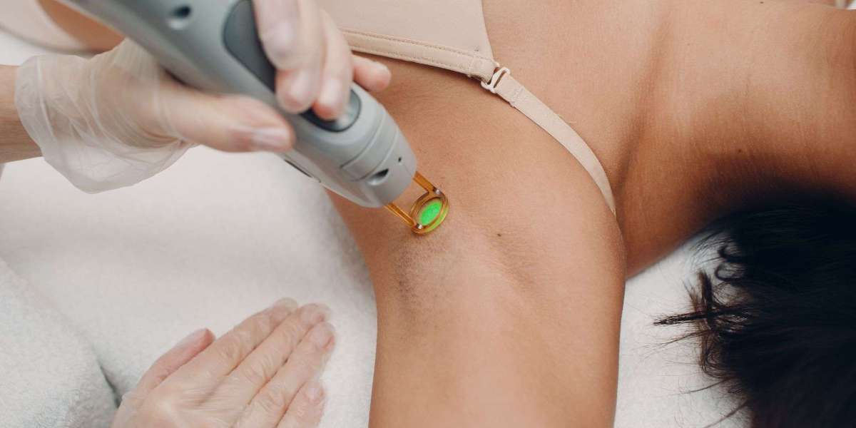 Bye-Bye Razor: The Best Avenue To Remove Hair Without Pain: Laser Hair Removal in Vizag | VJ’s Cosmetology Clinic