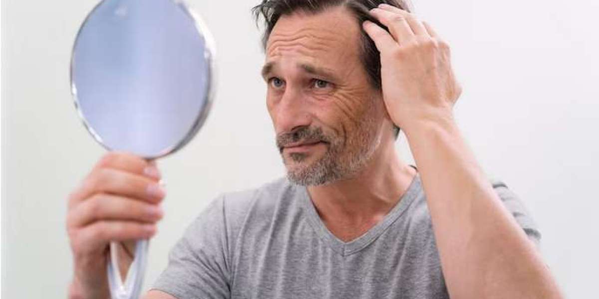 Breaking the Silence: Understanding Male Hair Loss and Taking Action