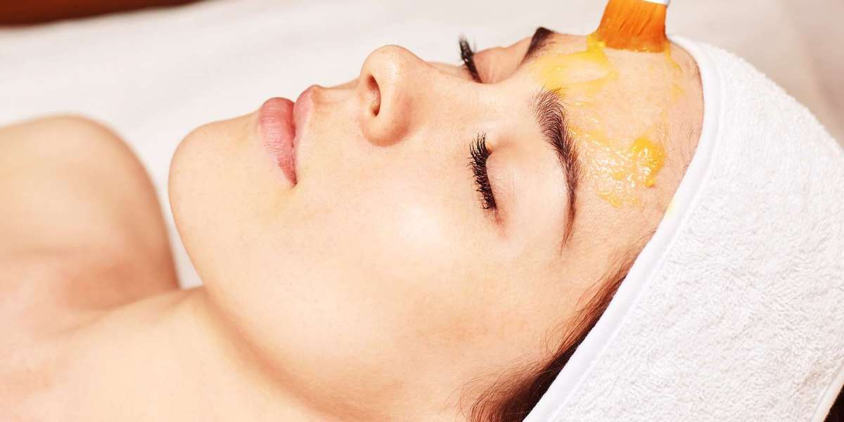 Reveal Radiance: The Ultimate Chemical Peel Experience"