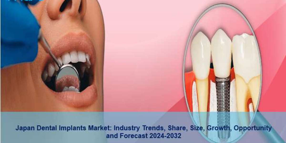Japan Dental Implants Market Trends, Size, Growth, Demand And Forecast 2024-2032