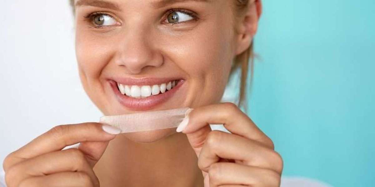 Radiant Smiles at Home: The Top 5 Teeth Whitening Methods