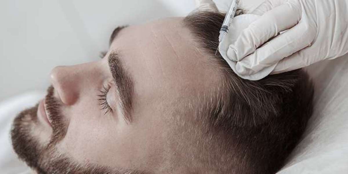 Regain Your Hair, Renew Your Confidence: PRP Hair Restoration Services in Dubai
