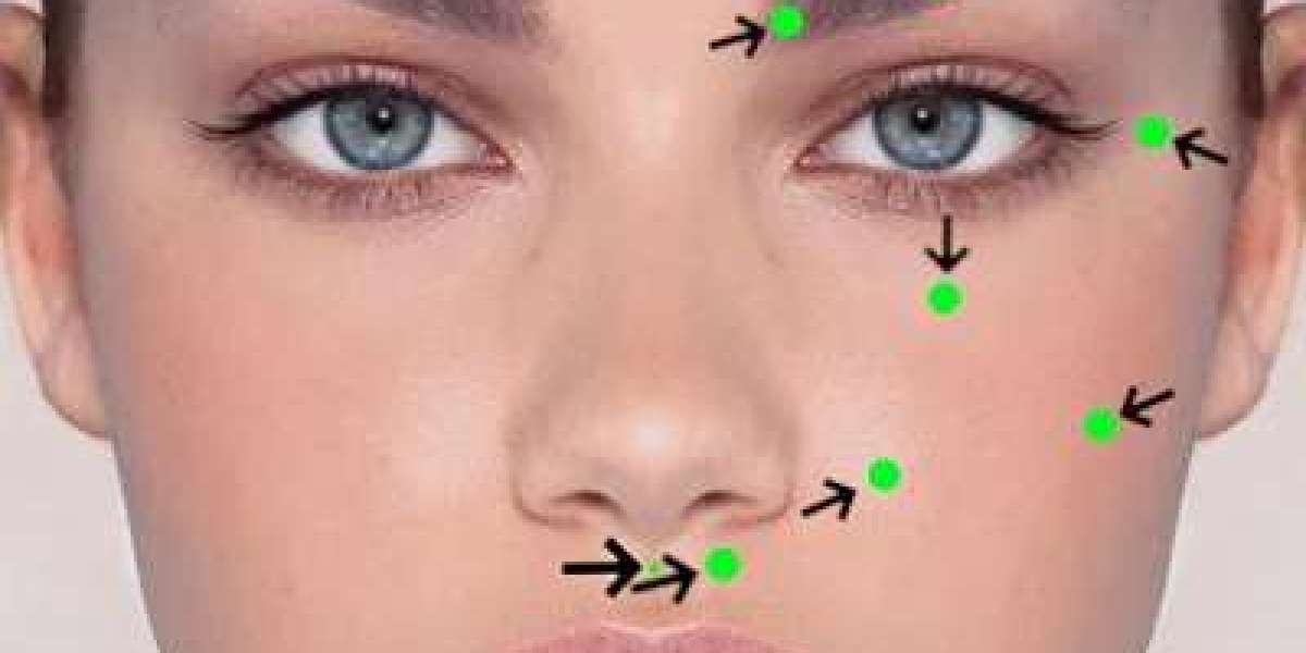 Facial Palsy Recovery Roadmap: Botox's Key Role