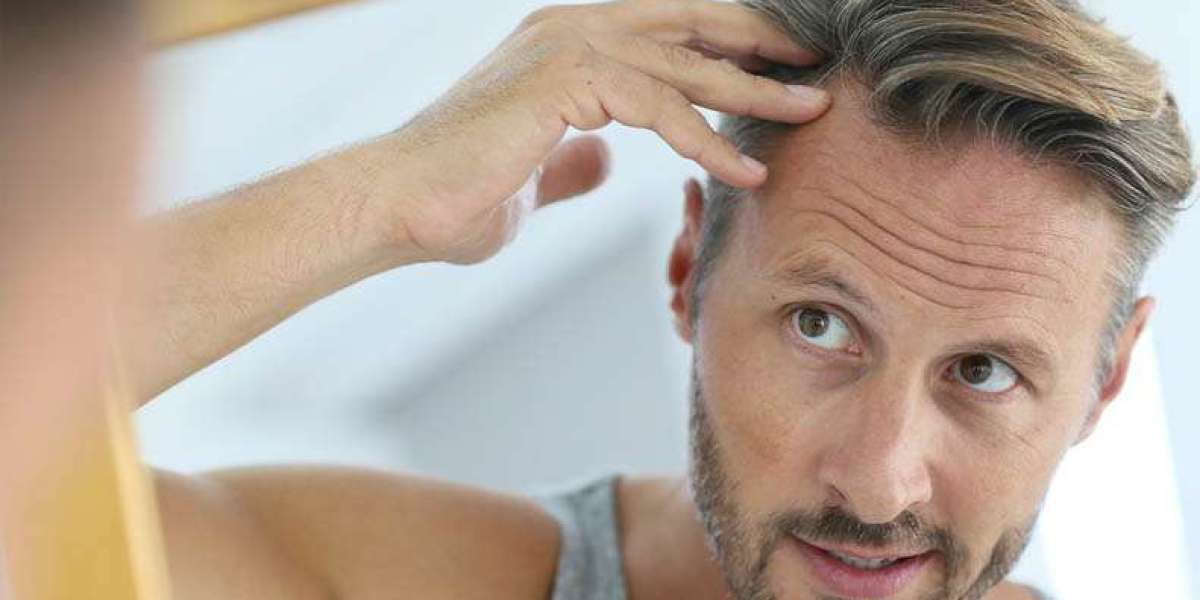 "From Baldness to Brilliance: FUE Hair Transplants Thriving in Dubai"